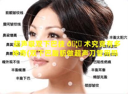 超声吸双下巴技 🦊 术究竟有多神奇(双下巴脂肪做超声刀管用吗)